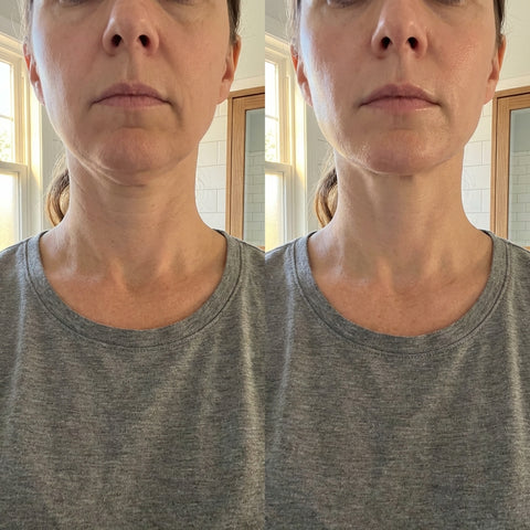 V-Line Lifting & Firming Mask