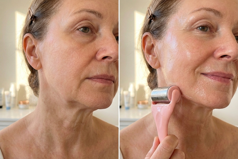 Ice Roller Facial Massager